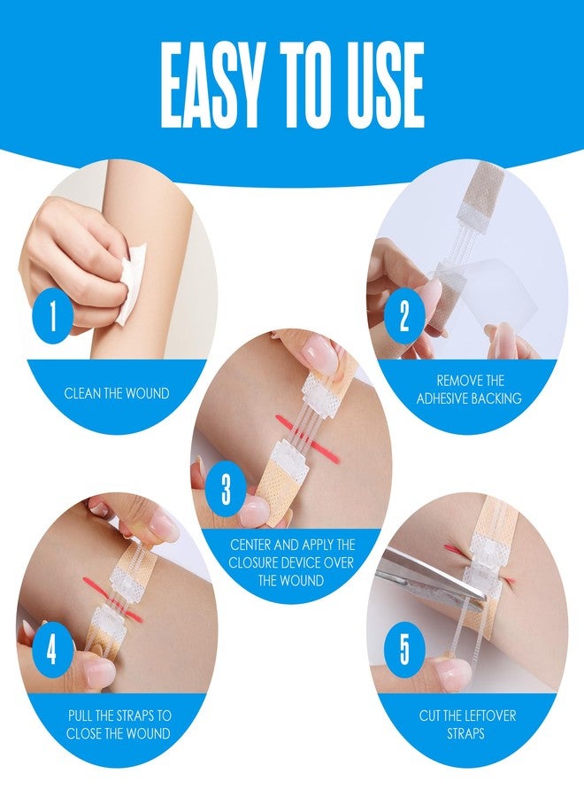 هاوسابلز ضمادات هاوسابلز بسحاب، ضمادات لإغلاق الجروح، ضمادات فراشة، ضمادات لإغلاق الجروح، غرز فراشة للجروح، طقم طوارئ للجروح، غرز بسحاب، ضمادة طوارئ جلدية بسحاب، عبوة من 4 قطع - Image 4